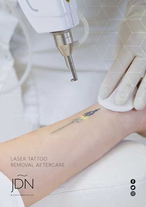 Tattoo Laser Removal Aftercare PDF
