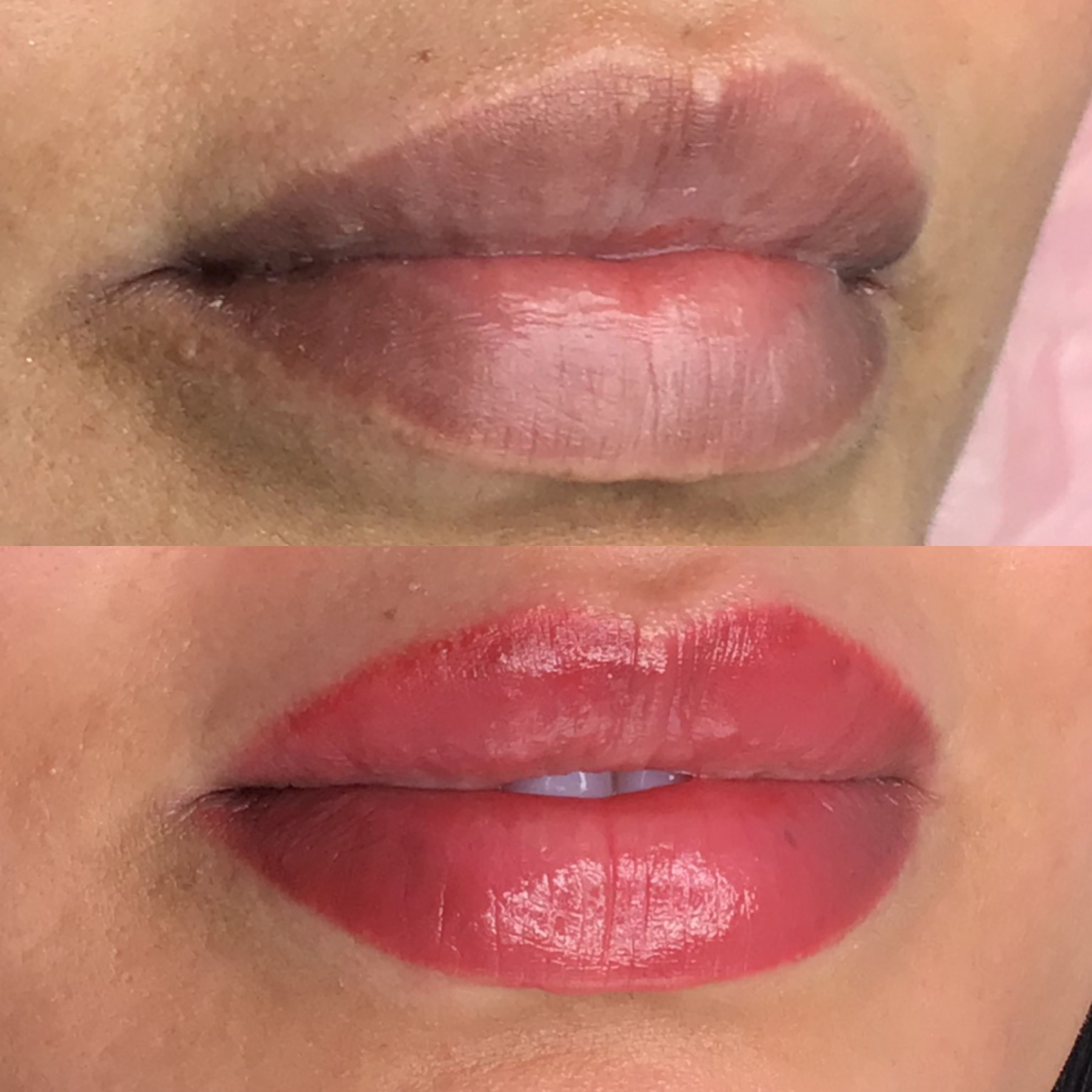 Lips Lips